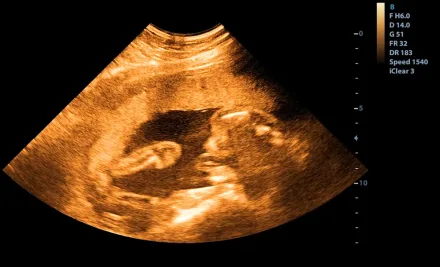 Condizioni Per Ottenere Risultati Positivi Con FIVET