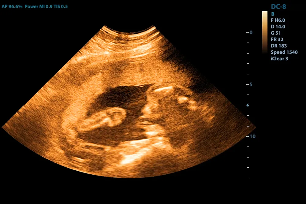 Condizioni Per Ottenere Risultati Positivi Con FIVET