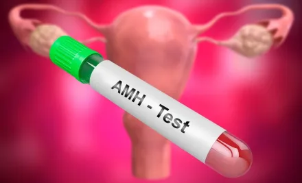 Cos’è il Test AMH? Riserva Ovarica, Rischio OHSS e Ruolo nella Fecondazione In Vitro
