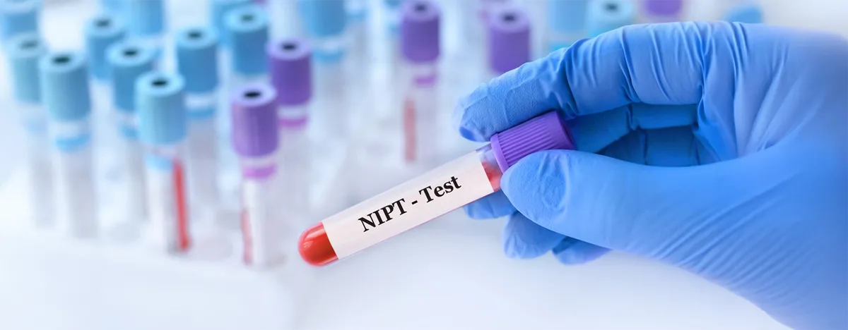 Test Prenatale Non Invasivo (NIPT)