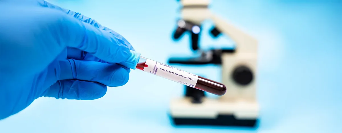 Test WES (Whole Exome Sequencing)